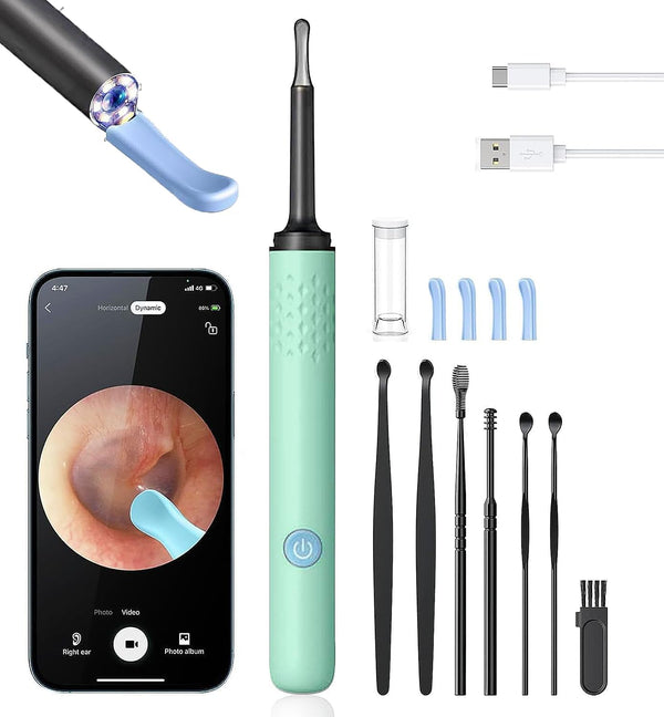 1080P Ear Wax Removal Tool with Camera & Light | Ear Cleaner
