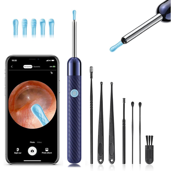Loyker X6 Ear Wax Removal Tool with Camera | Blue