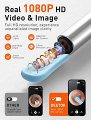 1080P Ear Wax Removal Tool with Camera | Otoscope with Light