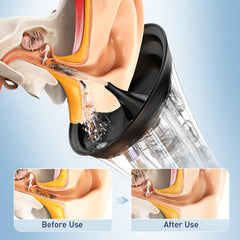 Electric Ear Wax Removal System | 6 Tips & 4 Pressure Settings