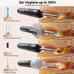 BEBIRD R1 Ultra 1296P HD Ear Wax Removal Tweezers