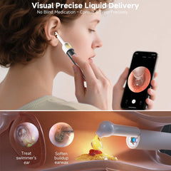 BEBIRD R1 Ultra 1296P HD Ear Wax Removal Tweezers