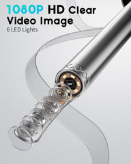 Loyker X6 1080P HD Ear Wax Removal Tool with Camera