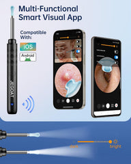 JEGOAT Ear Wax Removal Tool | 1296P HD Camera & 6 LED