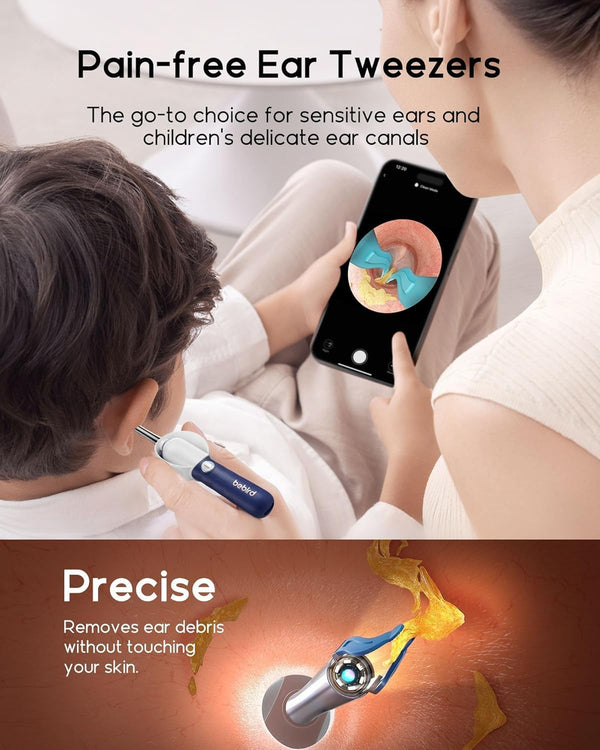Bebird D39R Ear Wax Removal Kit with Camera, Ear Cleaning Tweezers & Storage Case for Adults