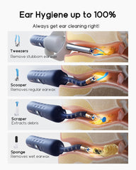 Bebird D39R Ear Wax Removal Tool with Ear Camera, Painless Tweezers & Storage Case