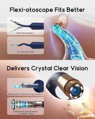 Bebird D39R Ear Wax Removal Tool with Ear Camera, Painless Tweezers & Storage Case