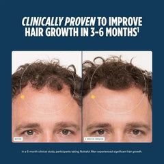 Men Hair Growth Nutraceuticals Dietary Supplement 120 Capsules