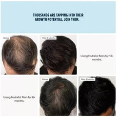 Men Hair Growth Nutraceuticals Dietary Supplement 120 Capsules